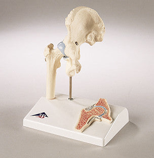 0233-Mi  Functional Mini-Hip Joint Model