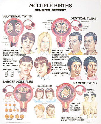 1336-01 Multiple Births Chart, unmounted