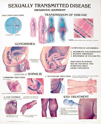 1341-01  Sexually Transmitted Diseases, Unmounted