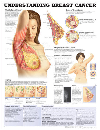 Understanding Breast Cancer