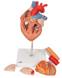 A313 Heart with Esophagus and Trachea