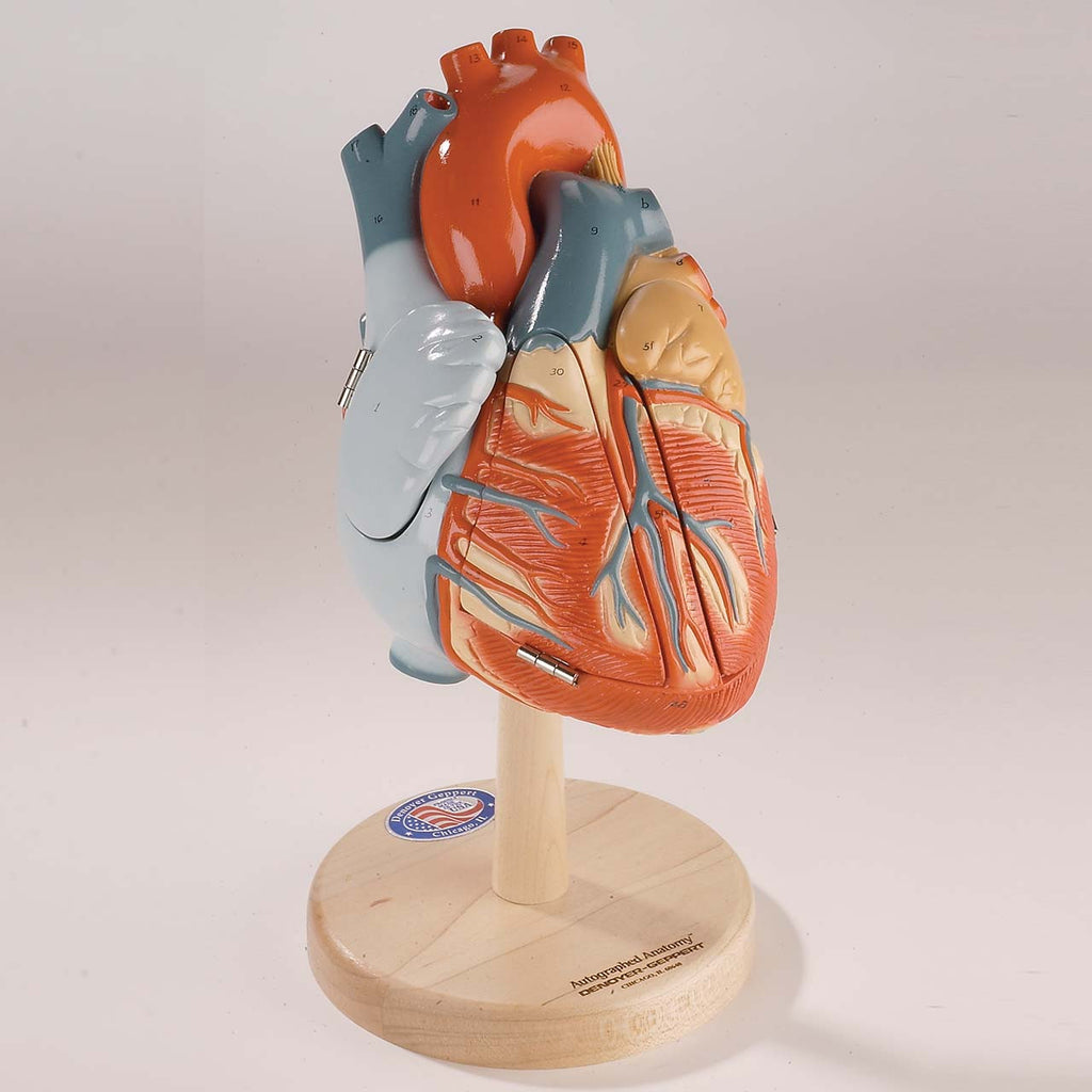 posterior interventricular artery model