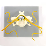 Cervical vertebra with spinal cord - top view