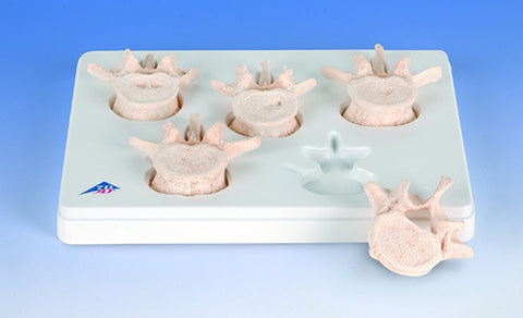 SB79-2 BONElike Lumbar Vertebrae, Set of 5