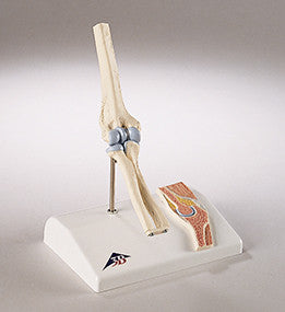 0234-Mi  Functional Mini-Elbow Joint