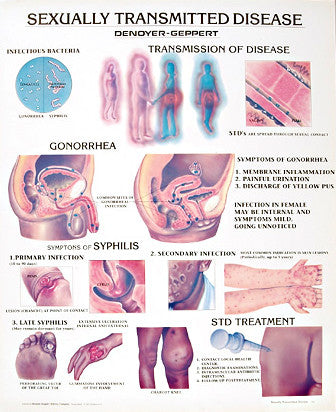 std symptoms chart