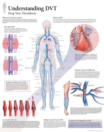 2162-08 Understanding Deep Vein Thrombosis