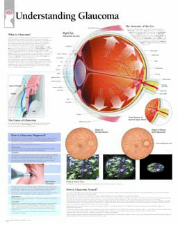 2225-08 Understanding Glaucoma