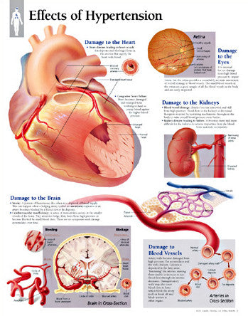 2451-08 Effects of Hypertension