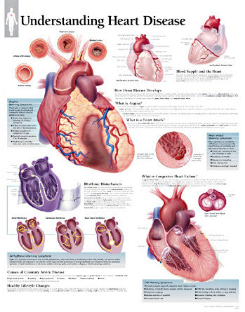 2454-08 Understanding Heart Disease