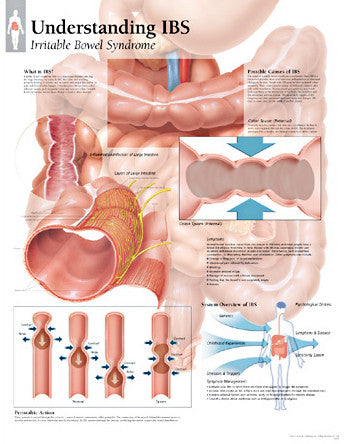 2551-08 Understanding IBS (irritable bowel syndrome)