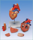 A313 Heart with Esophagus and Trachea