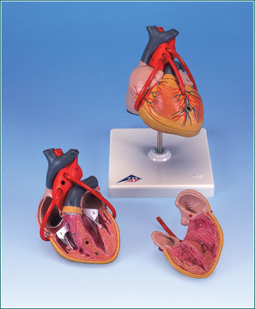 A385 Classic Heart with Bypass