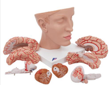 A525 Brain Model with Arteries Resting in Base of Head