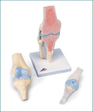SJ89  Sectional Knee Joint, 3-Piece