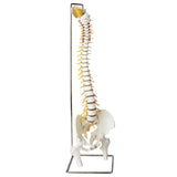 SP65 Premier Flexible Spine with herniated disc with femur heads and stand