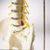 SP65 Premier Flexible Spine with herniated disc with femur heads and stand